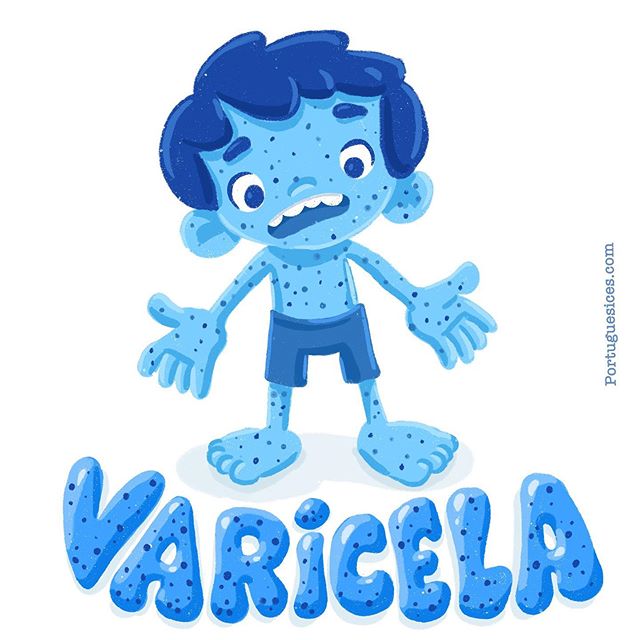 Varicela